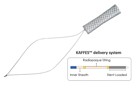 Biliary Kaffes Stent